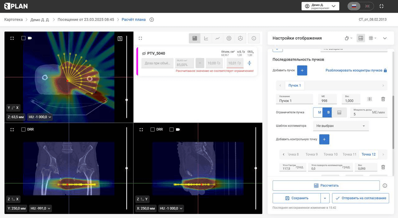 RPLAN — планирование по методике VMAT