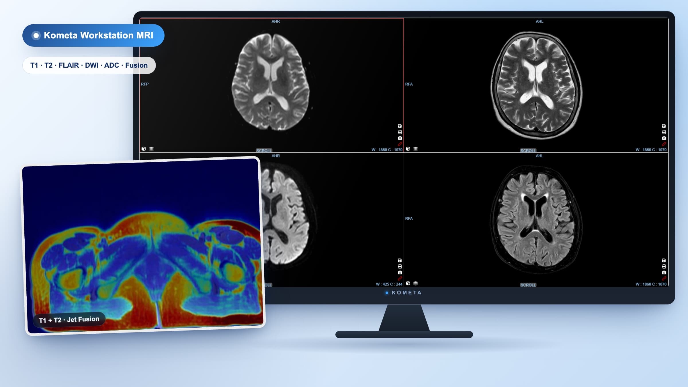 Kometa Workstation MRI
