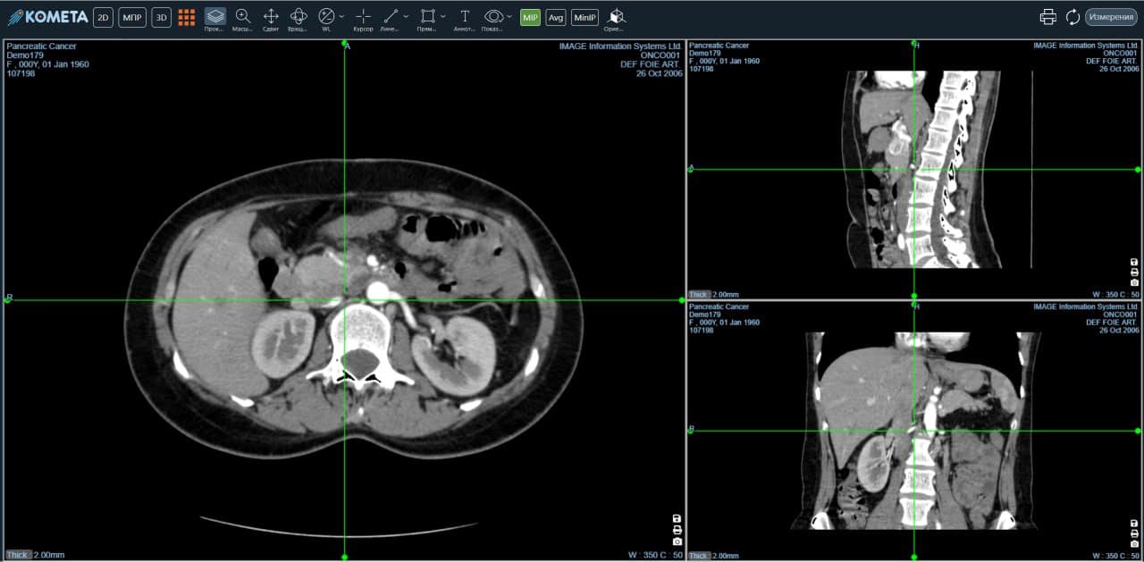 WEB Viewer 2