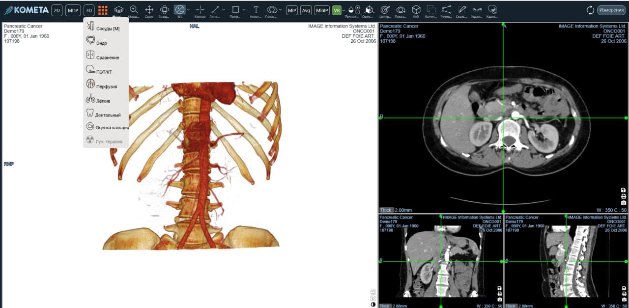 WEB Viewer 3