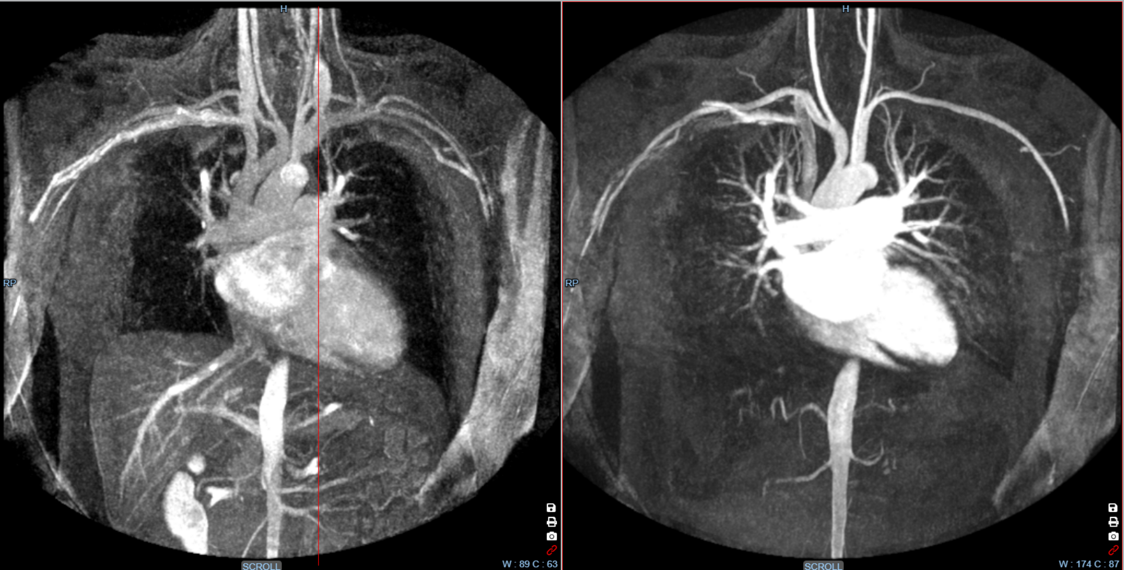 Kometa Workstation MRI — CT Liver Analysis
