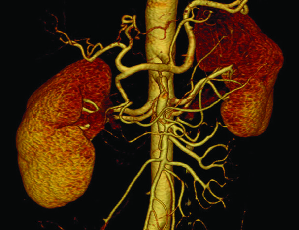 3D- реконструкция при исследовании мочевыделительной и дыхательной систем